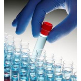 膜鐵轉(zhuǎn)運蛋白(FPN)多克隆抗體(Mouse_上海鈺博生物科技